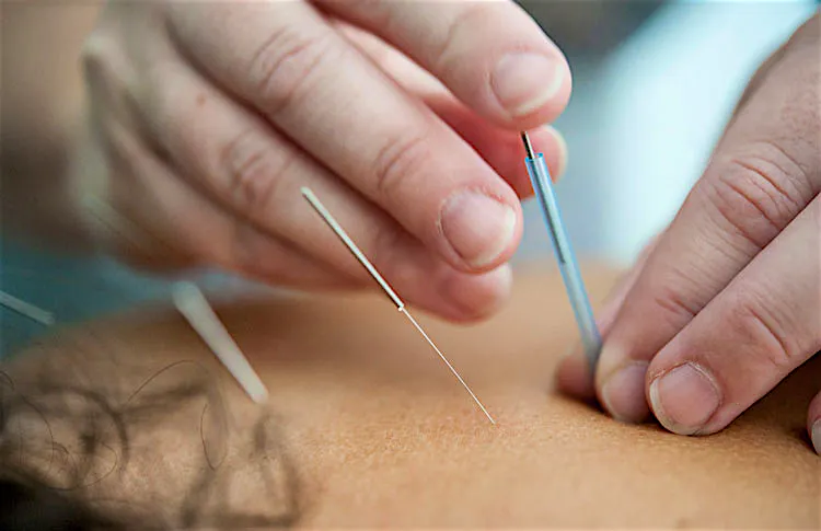 Assurance fautes professionnelles